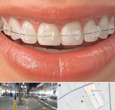 ارتودنسی اقساطی در باغ فیض اسلامشهر