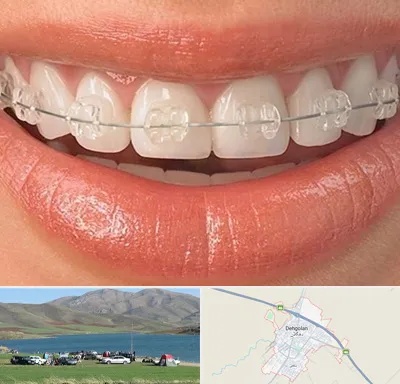 ارتودنسی اقساطی در دهگلان