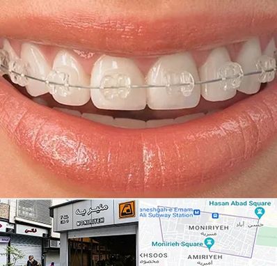 ارتودنسی اقساطی در منیریه 