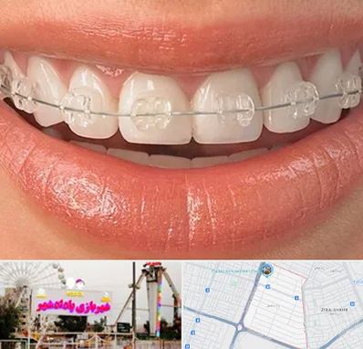 ارتودنسی اقساطی در پادادشهر اهواز