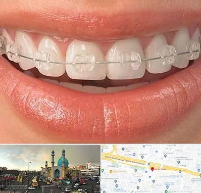 ارتودنسی اقساطی در رسالت 