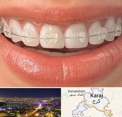 ارتودنسی اقساطی در کرج