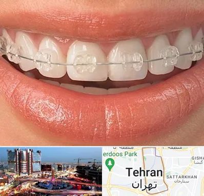 ارتودنسی اقساطی در صادقیه 