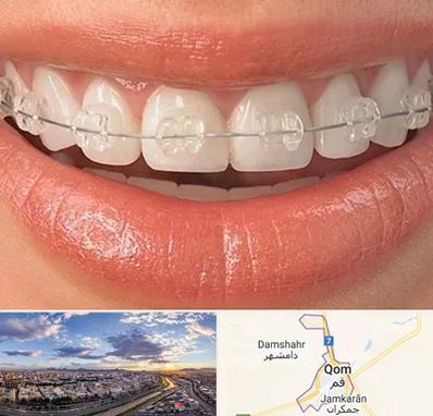 ارتودنسی اقساطی در قم