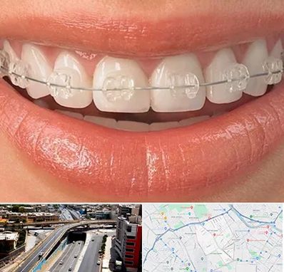 ارتودنسی اقساطی در ستارخان شیراز 