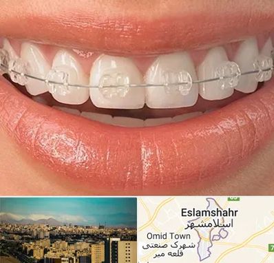 ارتودنسی اقساطی در اسلامشهر