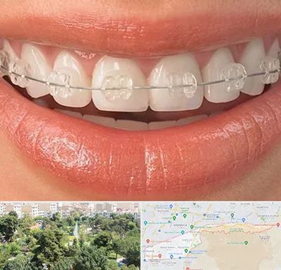 ارتودنسی اقساطی در منطقه 13 تهران 