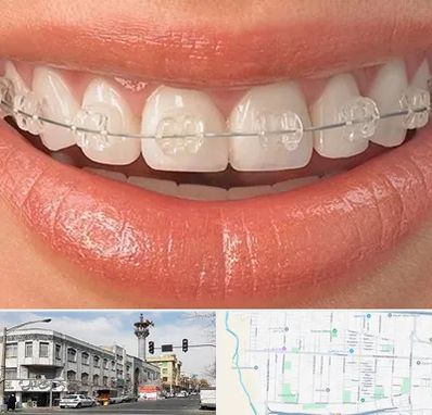 ارتودنسی اقساطی در 17شهریور