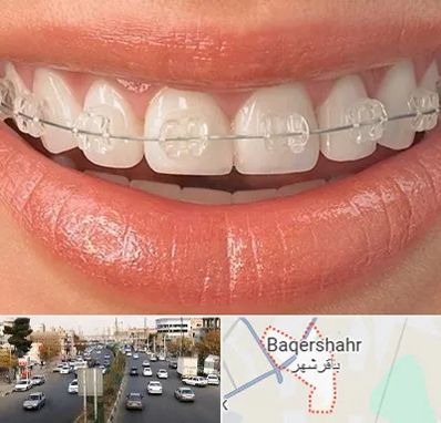 ارتودنسی اقساطی در باقرشهر