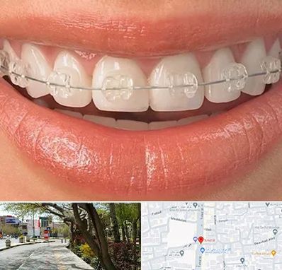 ارتودنسی اقساطی در خیابان توحید اصفهان 