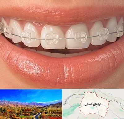 ارتودنسی اقساطی در خراسان شمالی