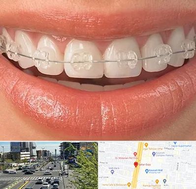 ارتودنسی اقساطی در ستاری 