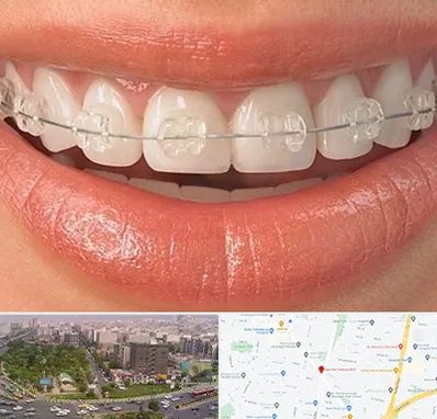 ارتودنسی اقساطی در آیت الله کاشانی 