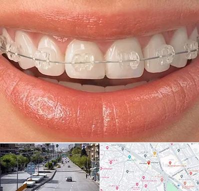 ارتودنسی اقساطی در خیابان زند شیراز 