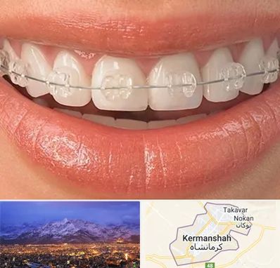 ارتودنسی اقساطی در کرمانشاه