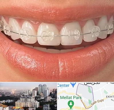 ارتودنسی اقساطی در الهیه 