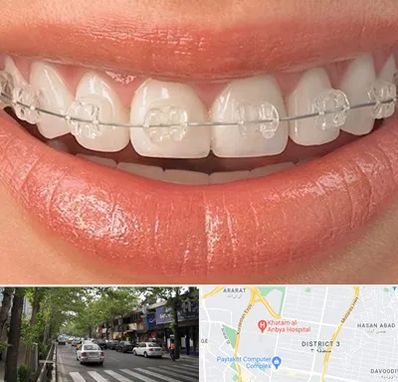 ارتودنسی اقساطی در ظفر 