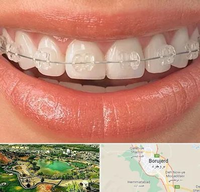 ارتودنسی اقساطی در بروجرد