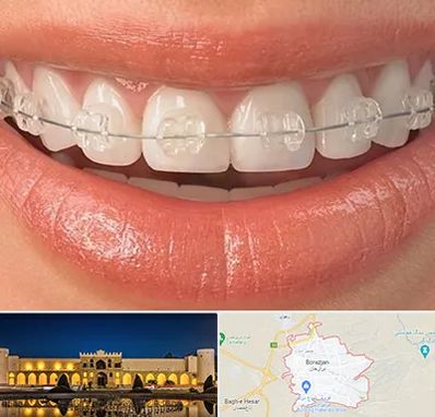 ارتودنسی اقساطی در برازجان