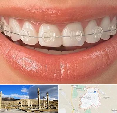 ارتودنسی اقساطی در مرودشت