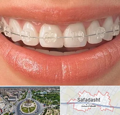 ارتودنسی اقساطی در صفادشت