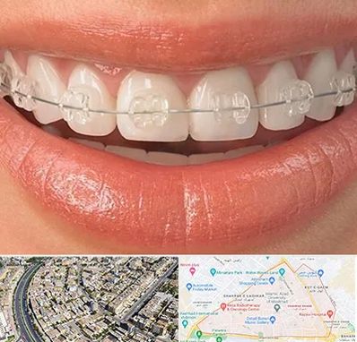 ارتودنسی اقساطی در شهرک غرب مشهد 