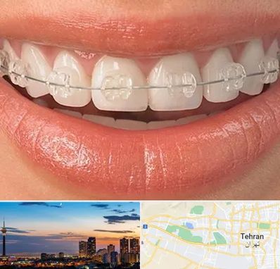 ارتودنسی اقساطی در غرب تهران 