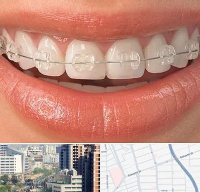 ارتودنسی اقساطی در خیابان بهشتی