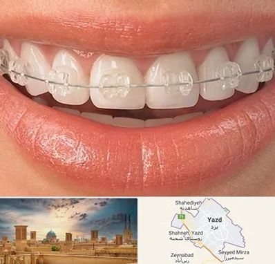 ارتودنسی اقساطی در یزد