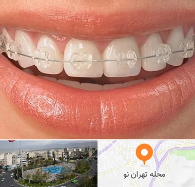 ارتودنسی اقساطی در تهران نو