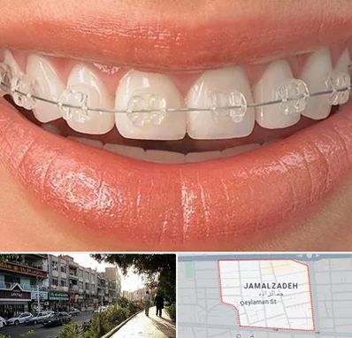 ارتودنسی اقساطی در خیابان جمالزاده