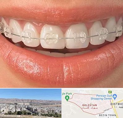 ارتودنسی اقساطی در شهرک گلستان شیراز 