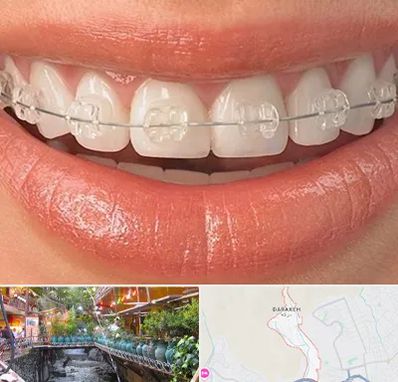 ارتودنسی اقساطی در درکه