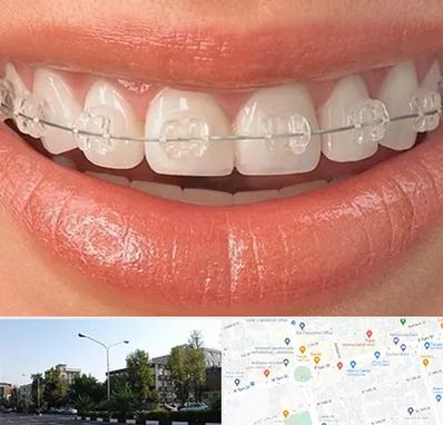 ارتودنسی اقساطی در میدان کاج 