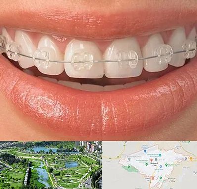 ارتودنسی اقساطی در بجنورد