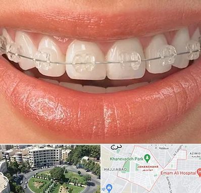 ارتودنسی اقساطی در جهانشهر کرج 