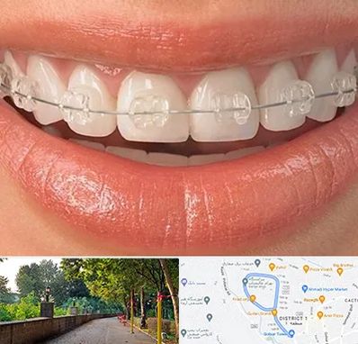 ارتودنسی اقساطی در فلکه گاز رشت 