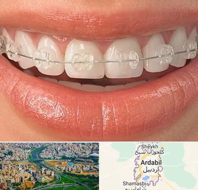 ارتودنسی اقساطی در اردبیل