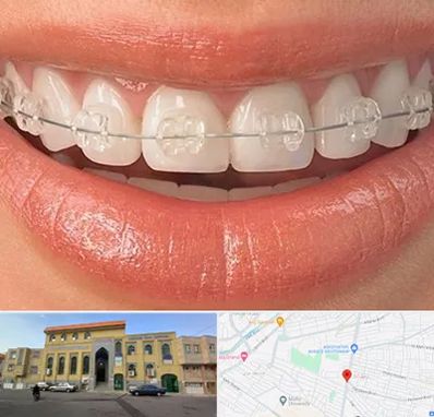 ارتودنسی اقساطی در زنبیل آباد قم