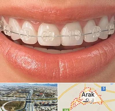 ارتودنسی اقساطی در اراک