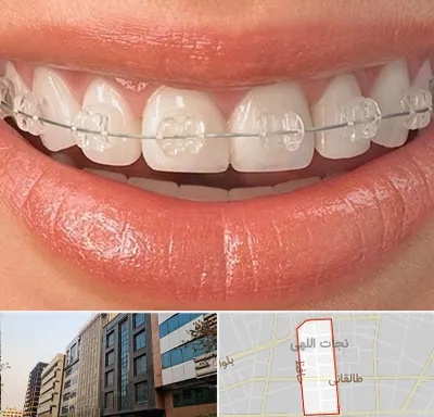 ارتودنسی اقساطی در نجات اللهی