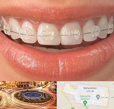 ارتودنسی اقساطی در بهارستان