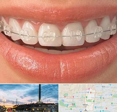 ارتودنسی اقساطی در منطقه 2 تهران 