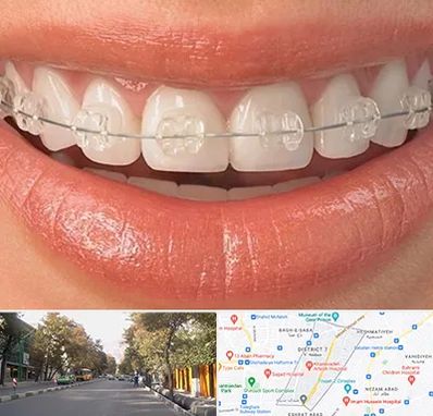 ارتودنسی اقساطی در شریعتی 