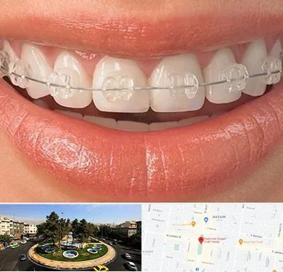 ارتودنسی اقساطی در هفت حوض 