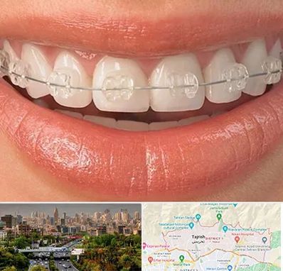 ارتودنسی اقساطی در منطقه 1 تهران 