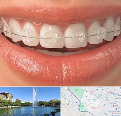 ارتودنسی اقساطی در کوهسنگی مشهد 