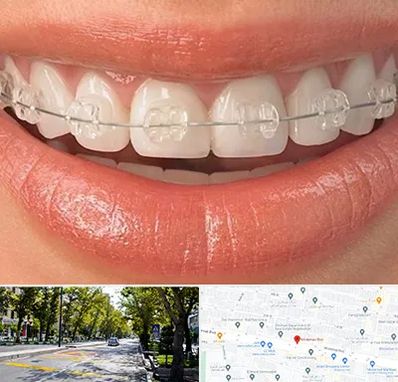 ارتودنسی اقساطی در میرداماد 