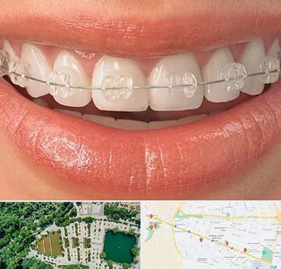 ارتودنسی اقساطی در وکیل آباد مشهد 