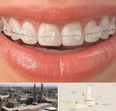 ارتودنسی اقساطی در سبزوار